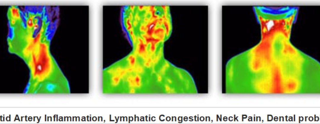 Thermography Images